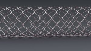 Another supported stent example pattern